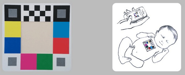 哪吒保贝测黄疸免费版使用方法1