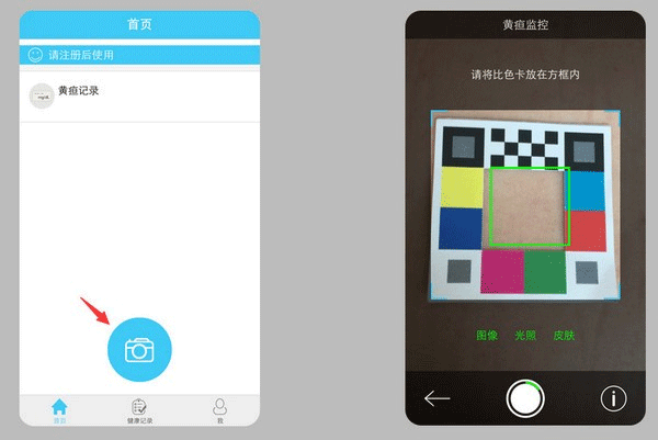 哪吒保贝测黄疸免费版使用方法2